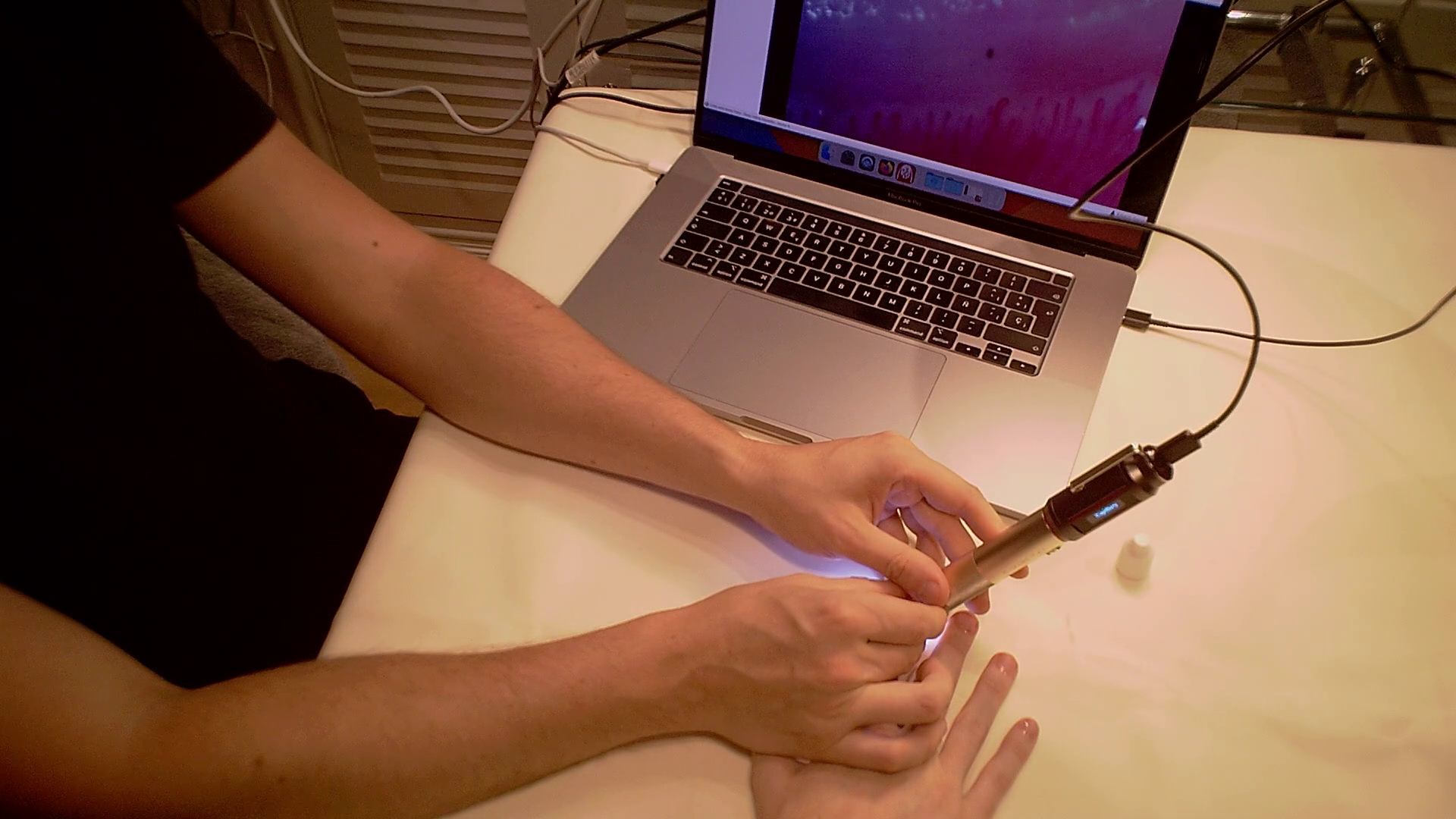 Applicazione desktop Capillary.io CapillaryScope usata con Smart G-Scope per eseguire una capillaroscopia