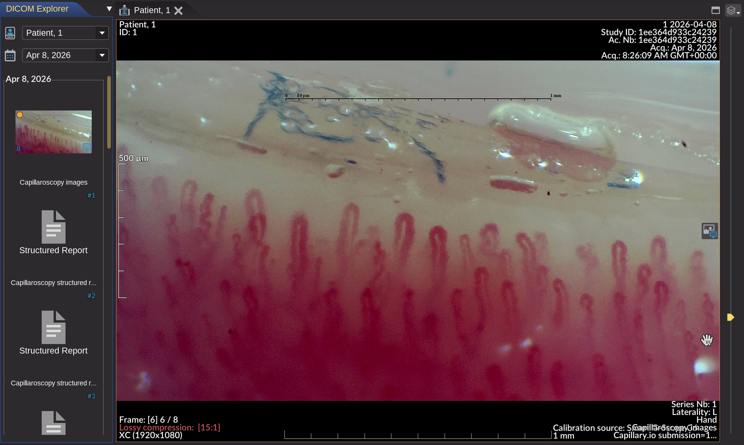 Scarica esportazioni ZIP DICOM da capillaroscopie e serie di capillaroscopie del paziente quando servono file di imaging interoperabili per sistemi clinici o archiviazione a lungo termine.