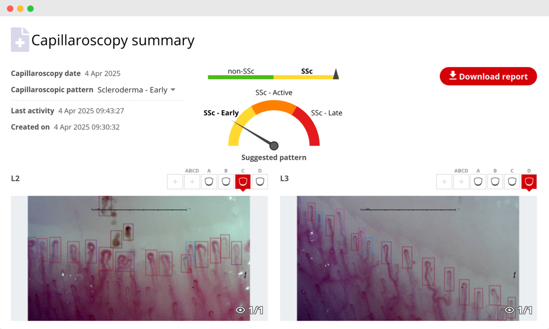 Screenshot del software per capillaroscopia