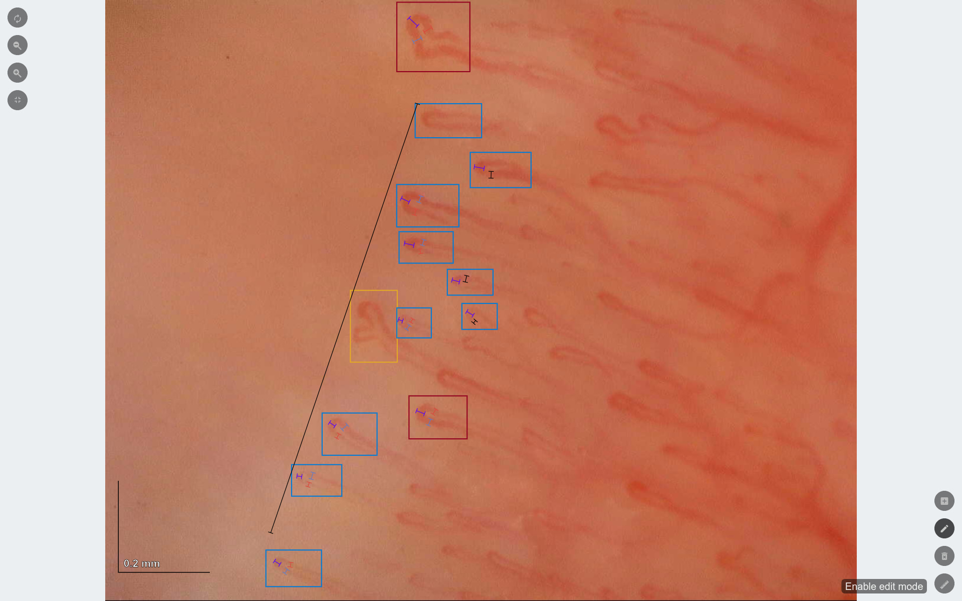 Capillary.io automatizza il rilevamento, la misurazione e la classificazione dei capillari in tutte le tue immagini, ma puoi facilmente visualizzare e modificare i capillari che ha rilevato per te.